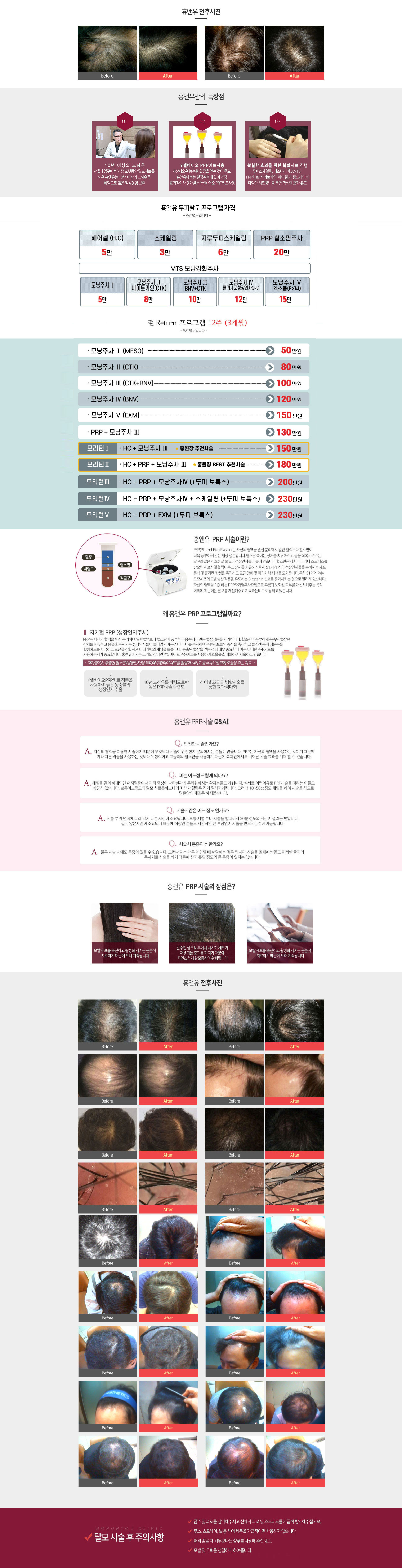 서브 콘텐츠 이미지