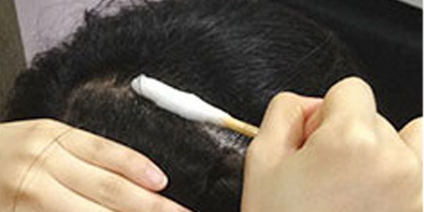 두피 스케일링 노폐물 스왑 스케일러 케어